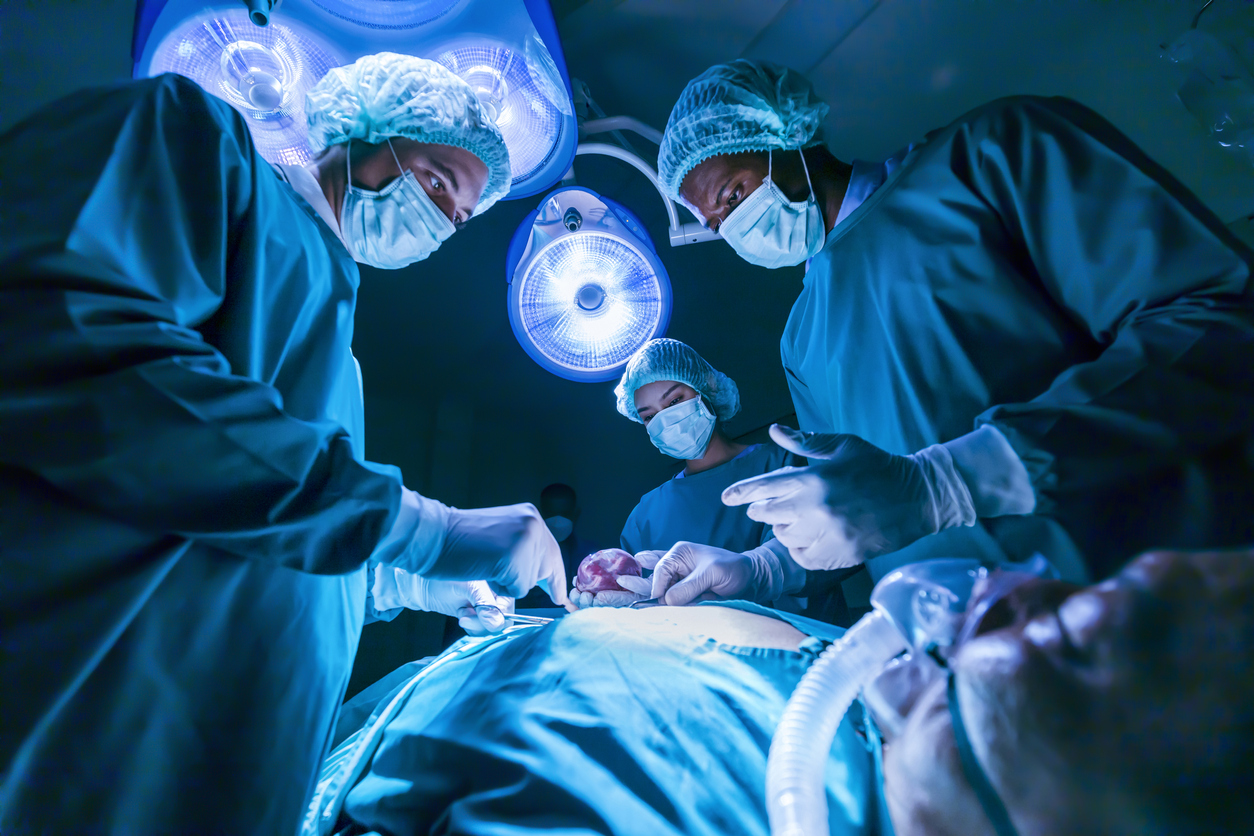 Pilonidal Cyst Surgery