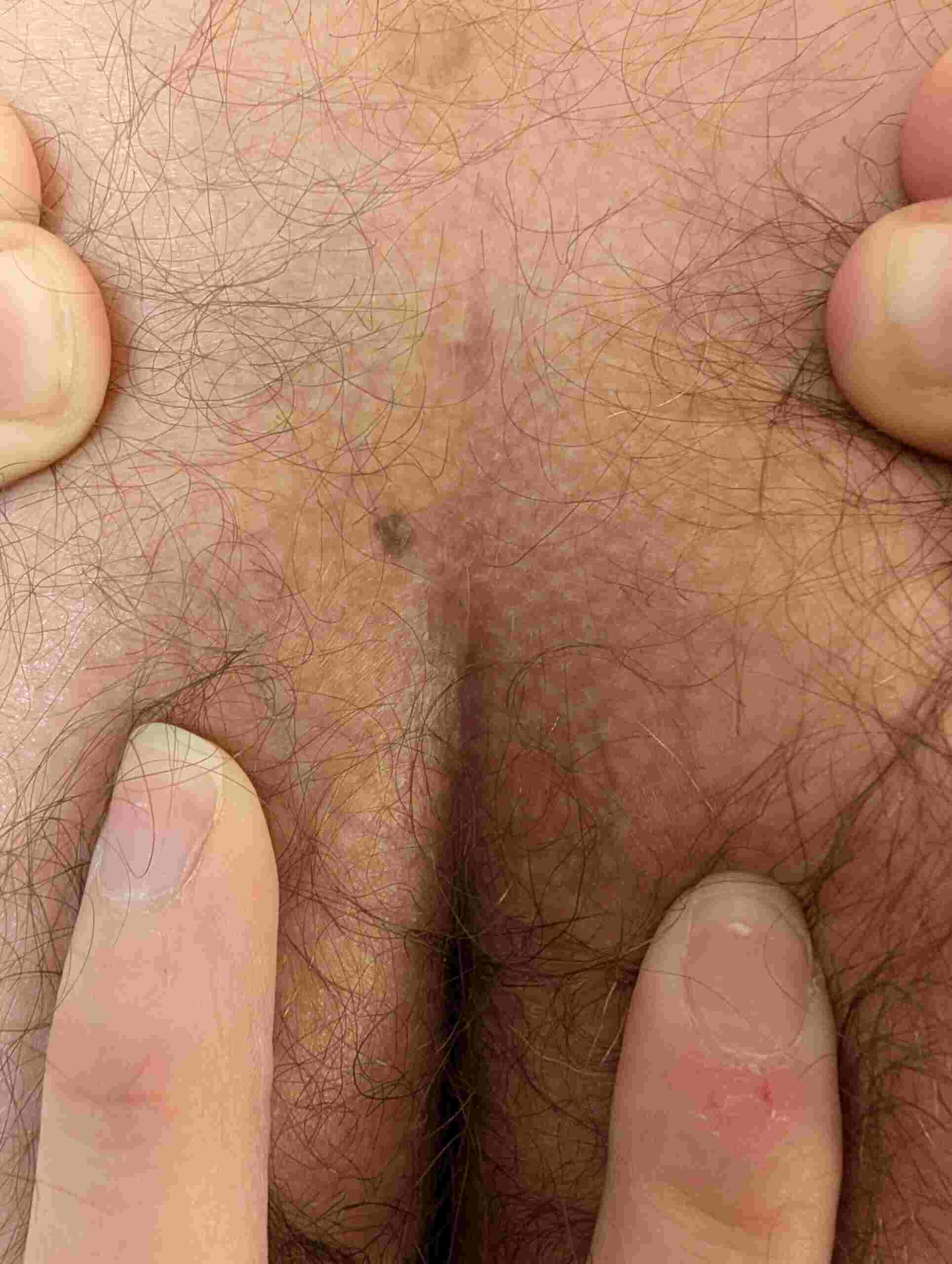 1 year post P1559926-768x512