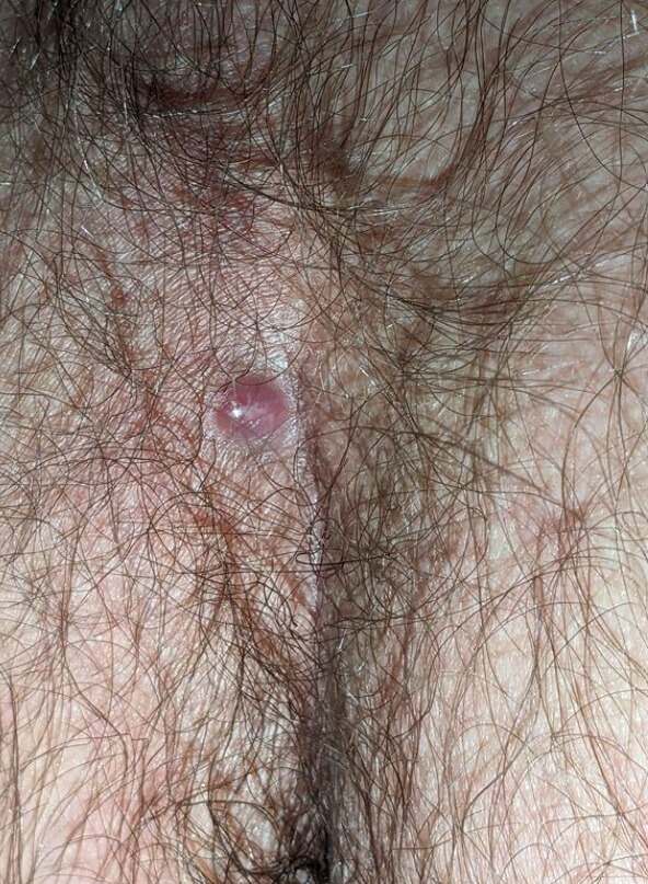 Pre Treatment 2 P1559926-768x512