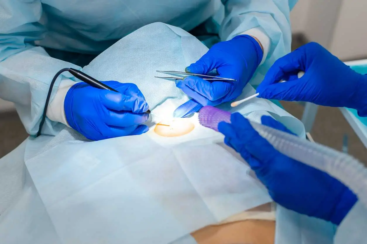 Understanding Surgery and Recovery