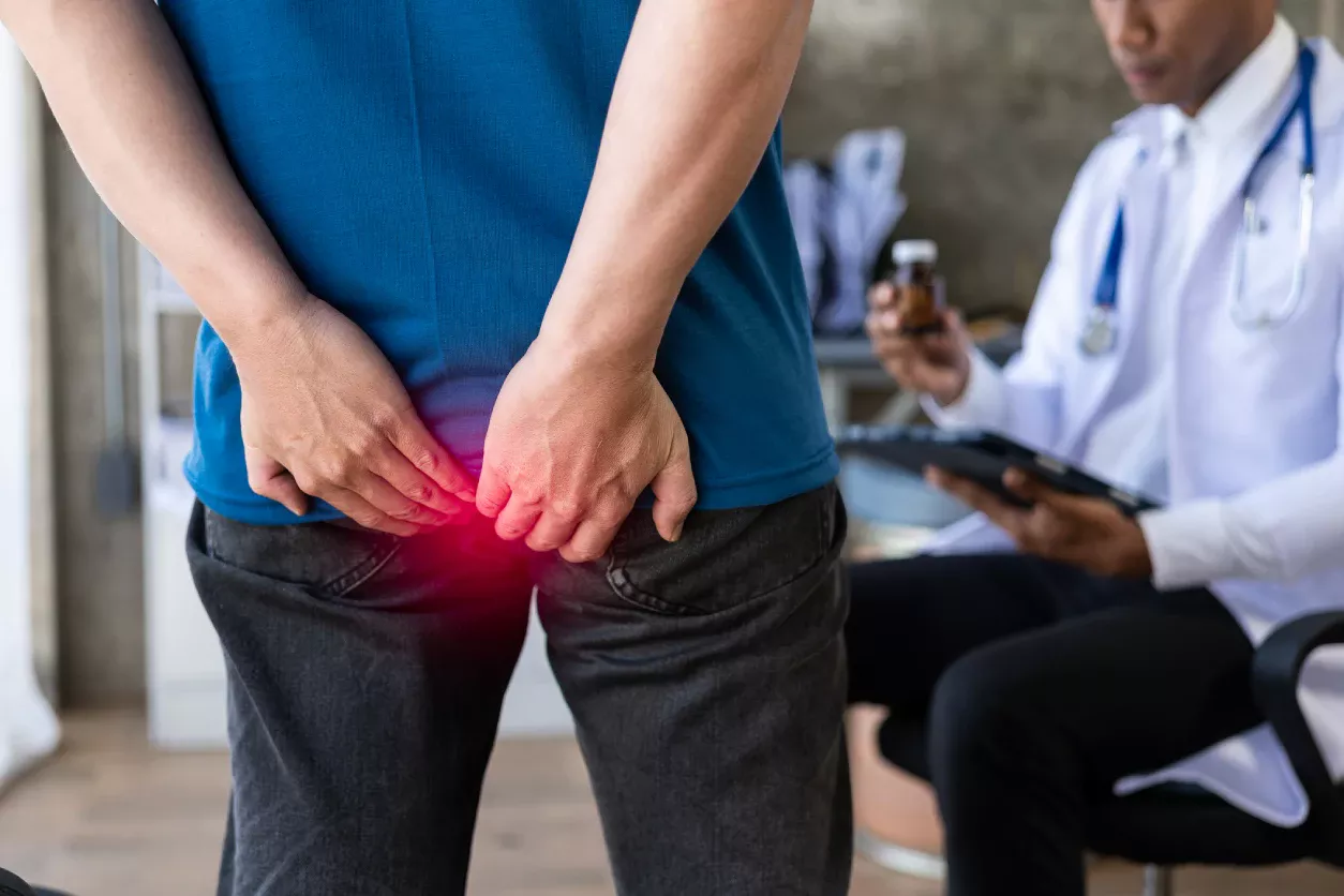 Pilonidal Cysts: Causes, Symptoms, and Modern Treatment Options