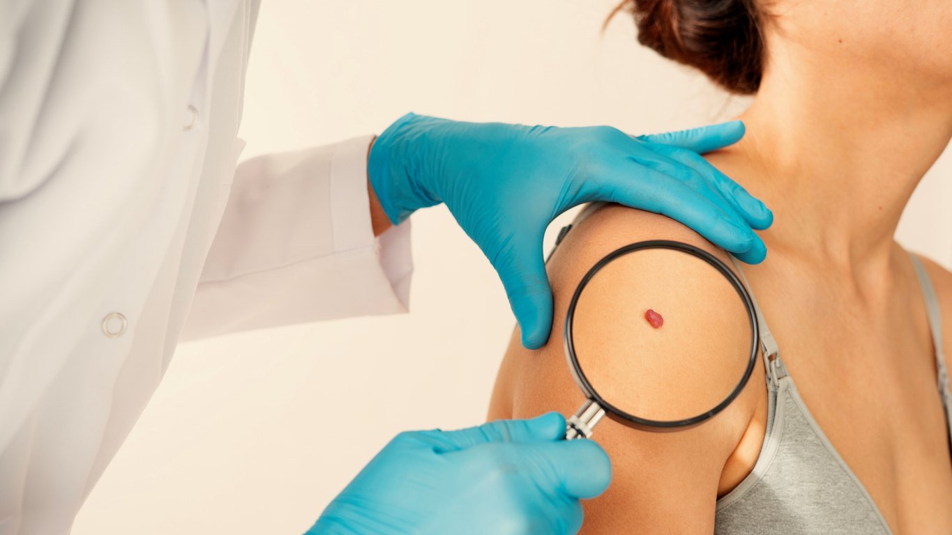 dermatologist checking cyst dermatologist checking cyst
