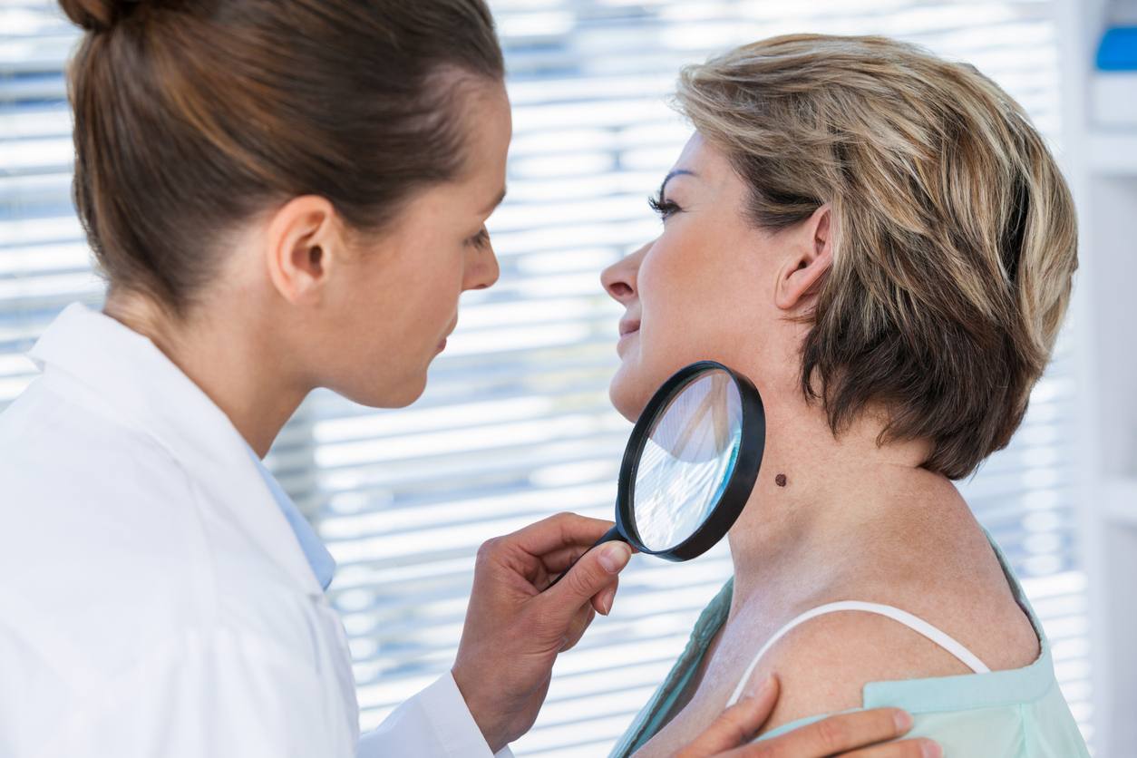skin cyst medical consultation skin cyst medical consultation