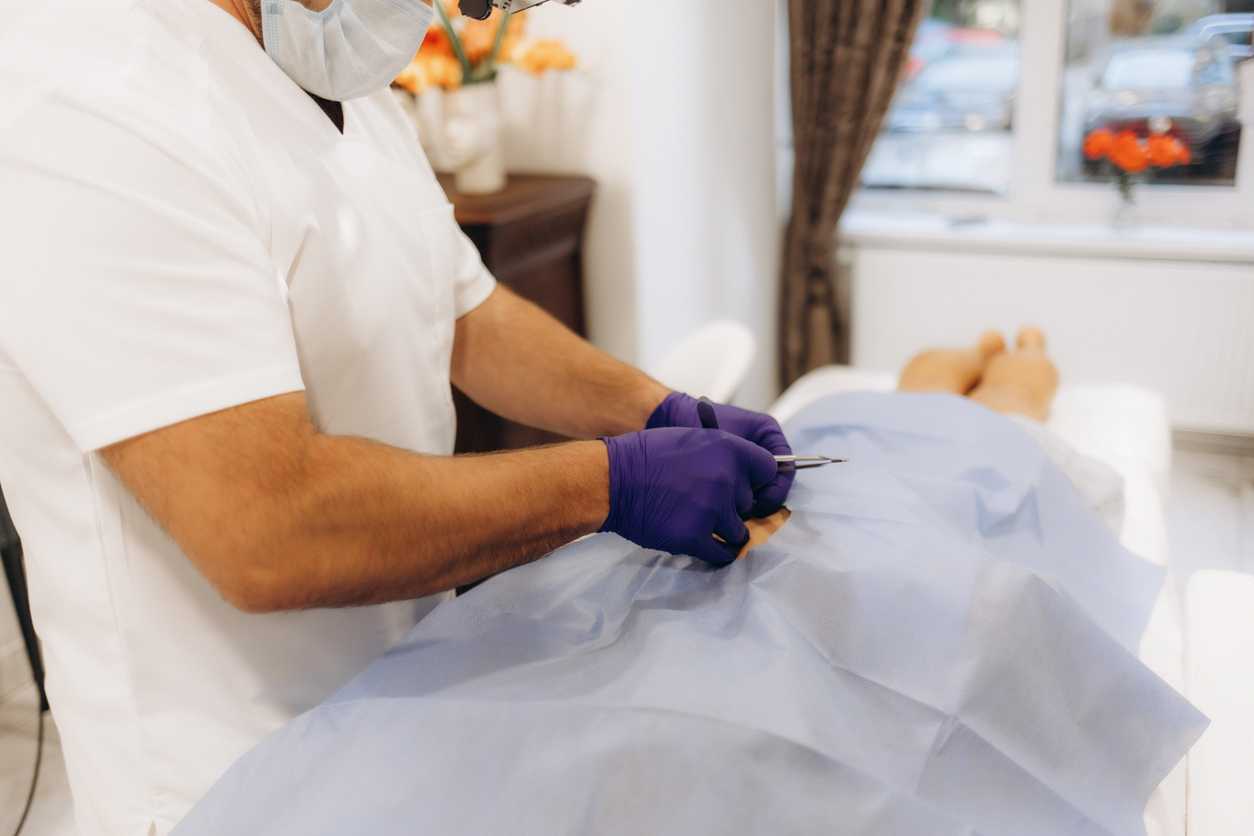 Pilonidal cyst operation Surgical Management of Repeated Pilonidal Disease